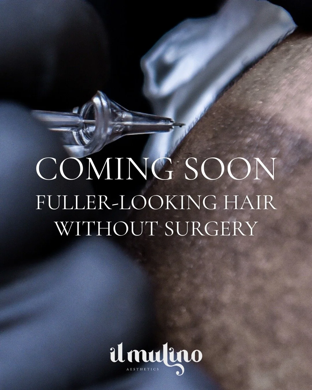 Something new is coming to Il Mulino Aesthetics 👀 

Scalp Micropigmentation (SMP) is a non-surgical treatment that creates the look of fuller hair and natural-looking follicles&mdash;perfect for thinning areas, receding hairlines, and adding density