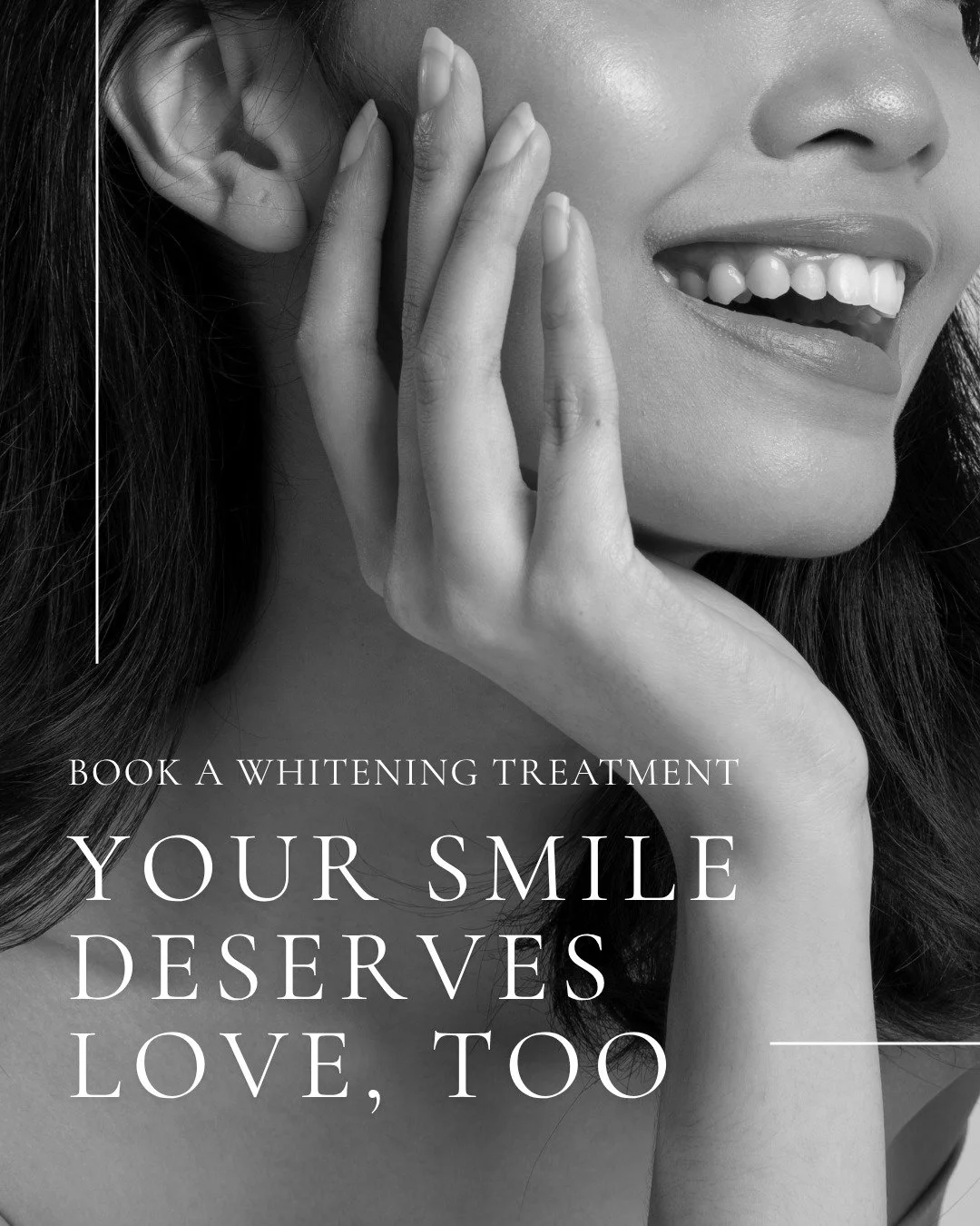 Your smile deserves a little love, too ✨

Our High Performance Teeth Whitening treatment is fast, effective, and done right here in our office &mdash; no trays, no waiting, just results.

Ready to brighten your smile? Book your appointment today. 👇
