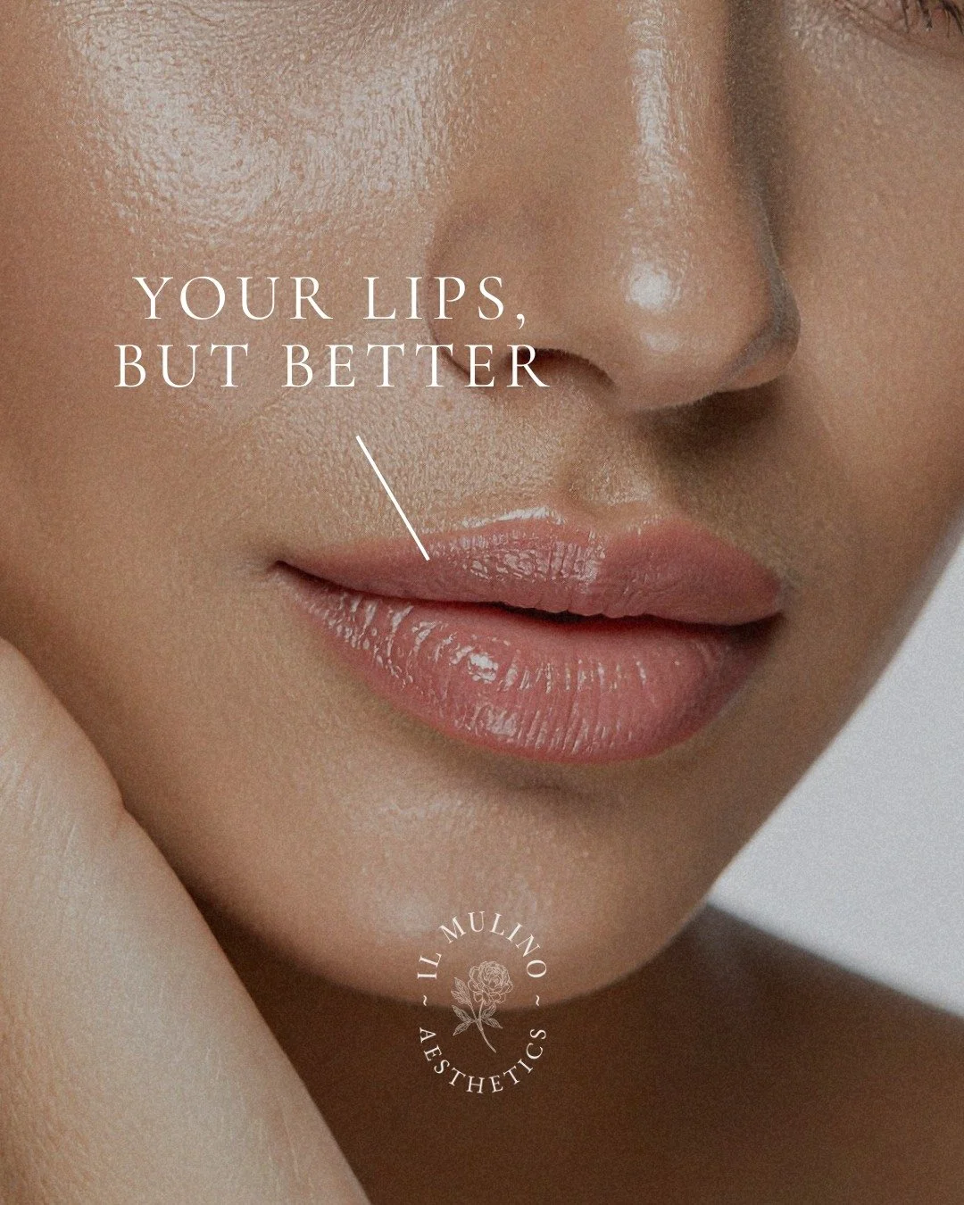 Your lips, but better💋 We're all about balance and hydration here. An occasional, subtle lip filler refresh keeps lips soft, hydrated, and naturally plump.

Think of it as enhancing what you already have, not changing who you are. 

Have questions f