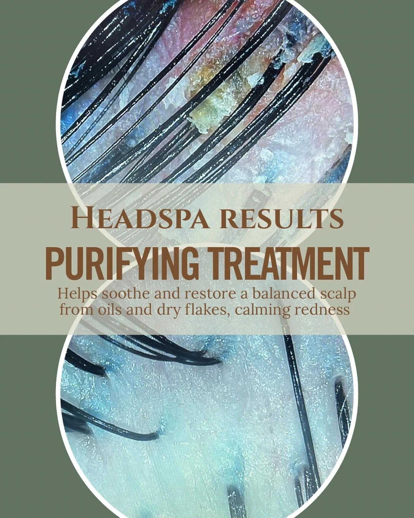 The headspa results 🧖🏻&zwj;♀️
We utilize clinical-grade products that address various scalp concerns, promoting a nourished and balanced scalp.
The benefits extend beyond the treatment room, leaving you with a personalized regimen to tackle your sc