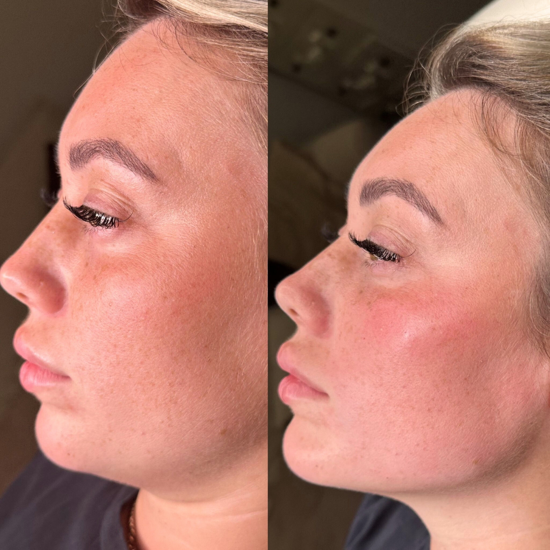 glo post templates - 16.PNG