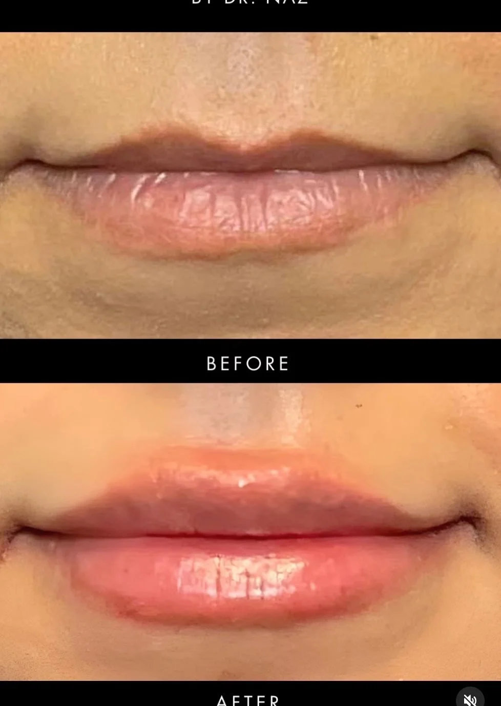 Nazed Lips