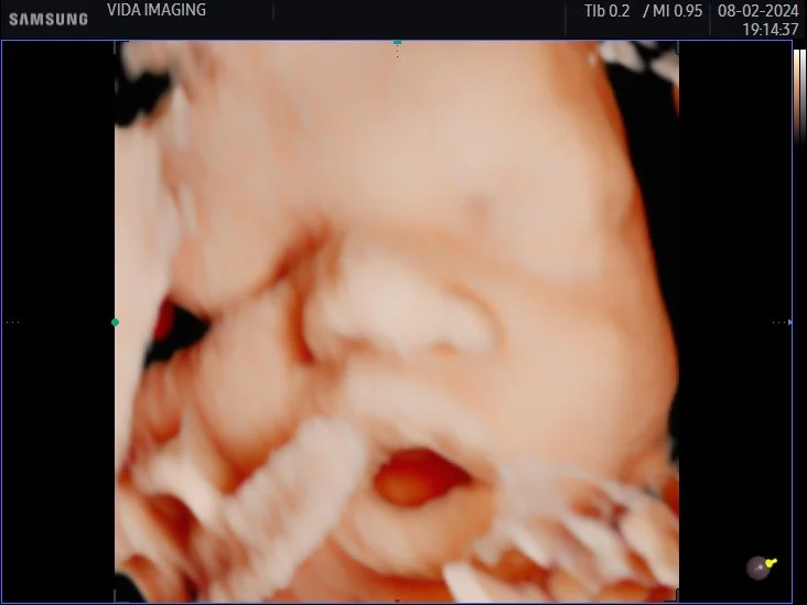 % Vida Imaging| 3D/4D & Diagnostic Ultrasound in Houston, TX
