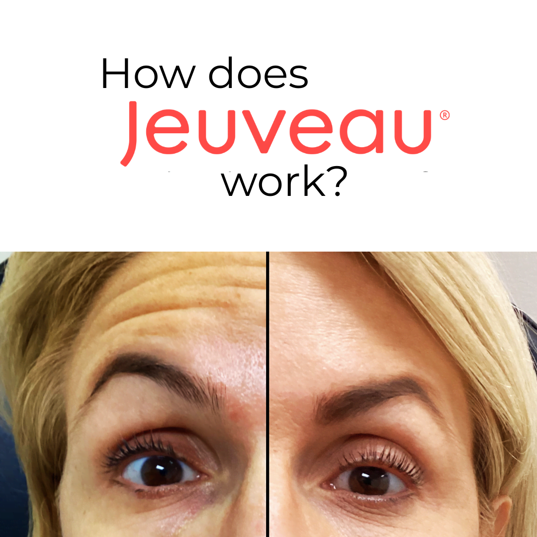A Modern Way to Smooth Wrinkles - and How Jeuveau Works