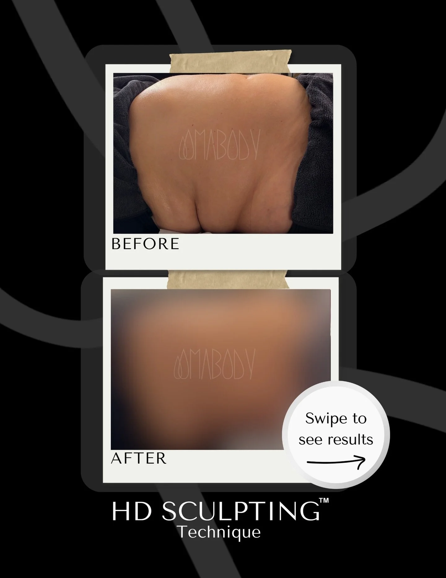 Every body is different, but we love a good challenge. We customize our treatments to every body type, using our proprietary protocol to deliver amazing results. Then, the rest is up to you - hydrating and following your aftercare instructions to a T