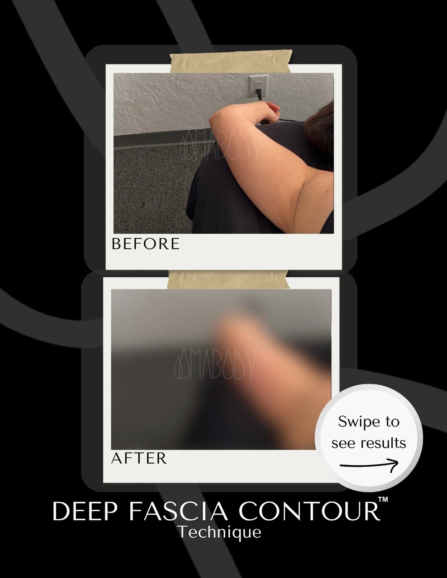 We are the home of the Deep Fascia Contour. This is not a one-size fits all treatment. This is not a deep tissue massage either. It&rsquo;s a customized body system reprogramming of fascia, lymph and connective tissue to mold your body for ease in re