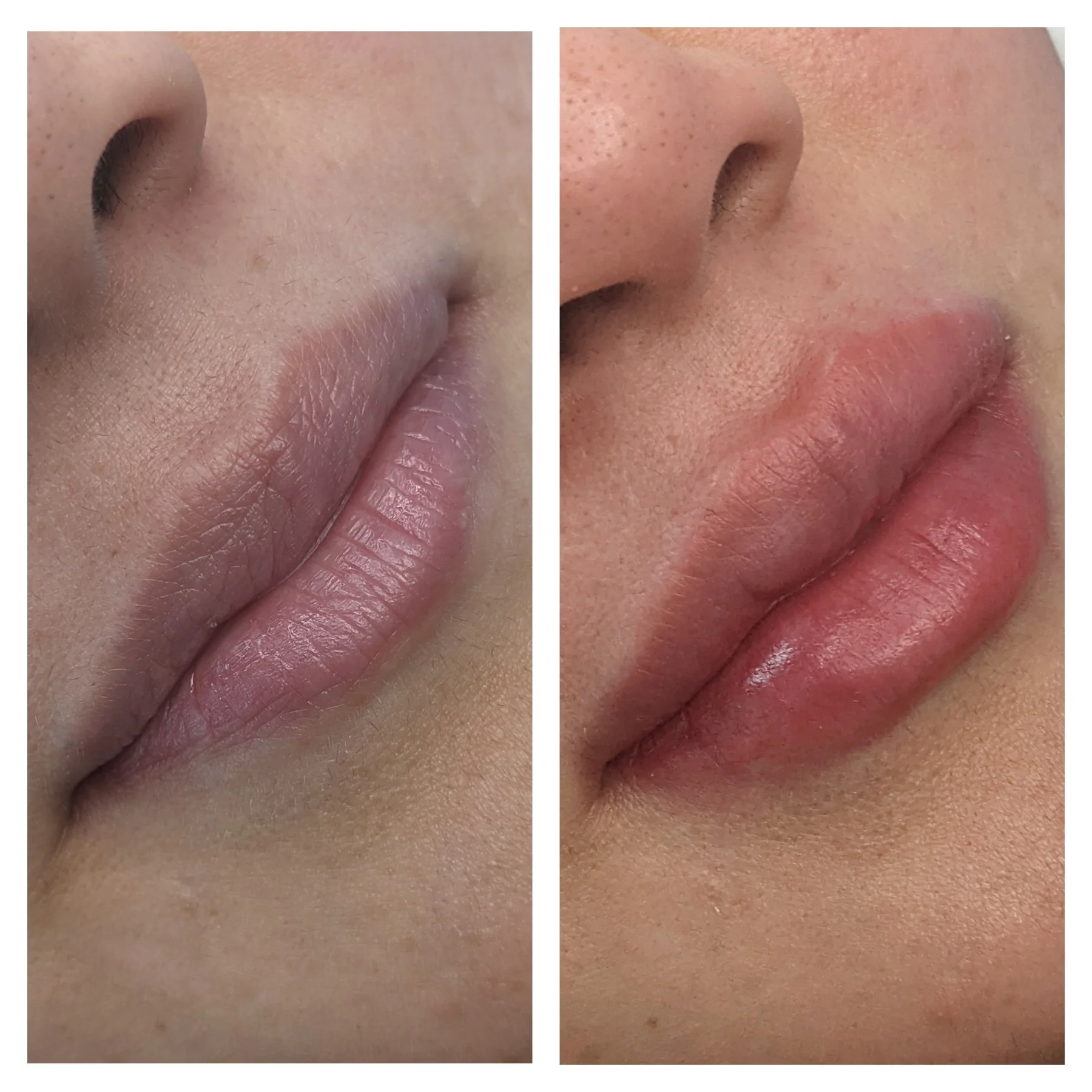 Close-up of a person's lips, showing before and after images of a natural lip blush. The left side shows dry, pale lips, and the right side shows moisturized, slightly pink lips.