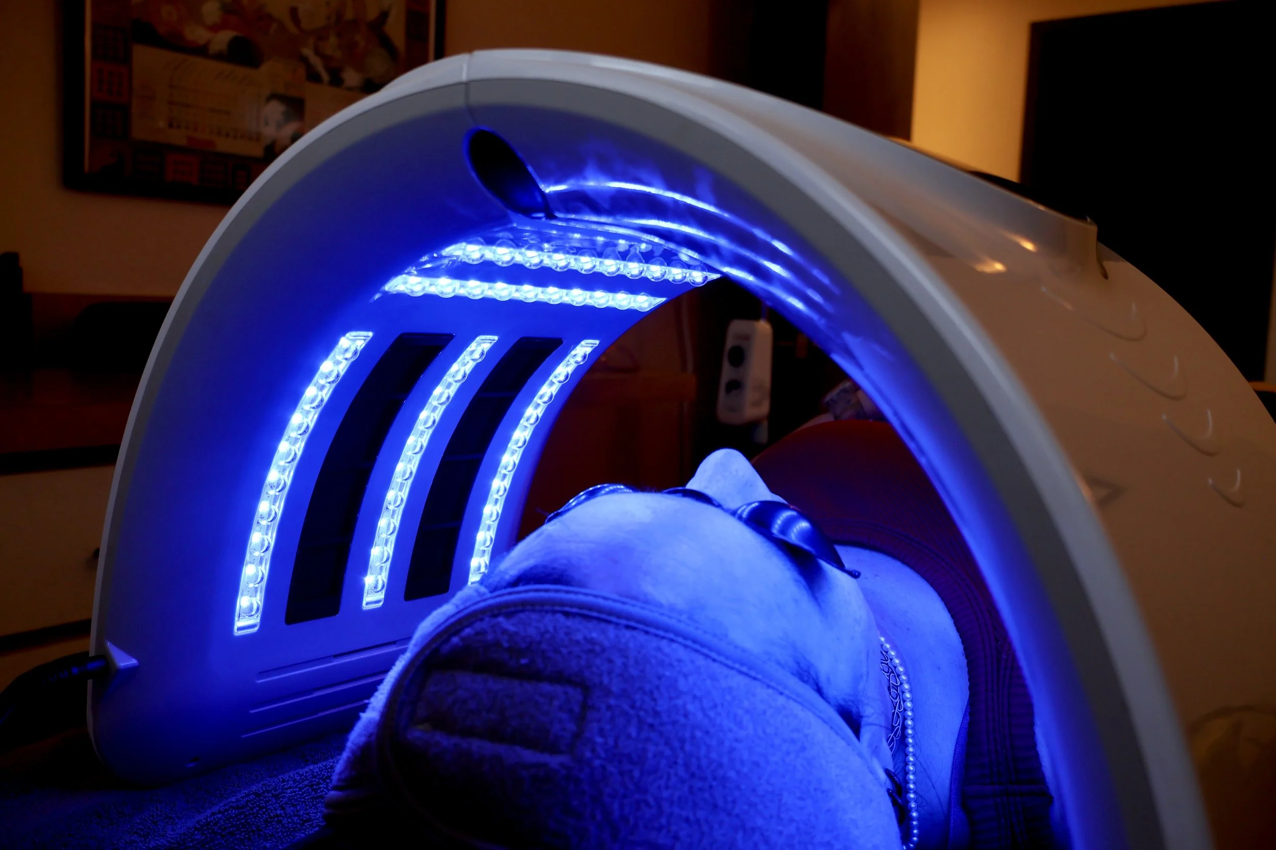 A woman lying down with a blue LED light over her face.