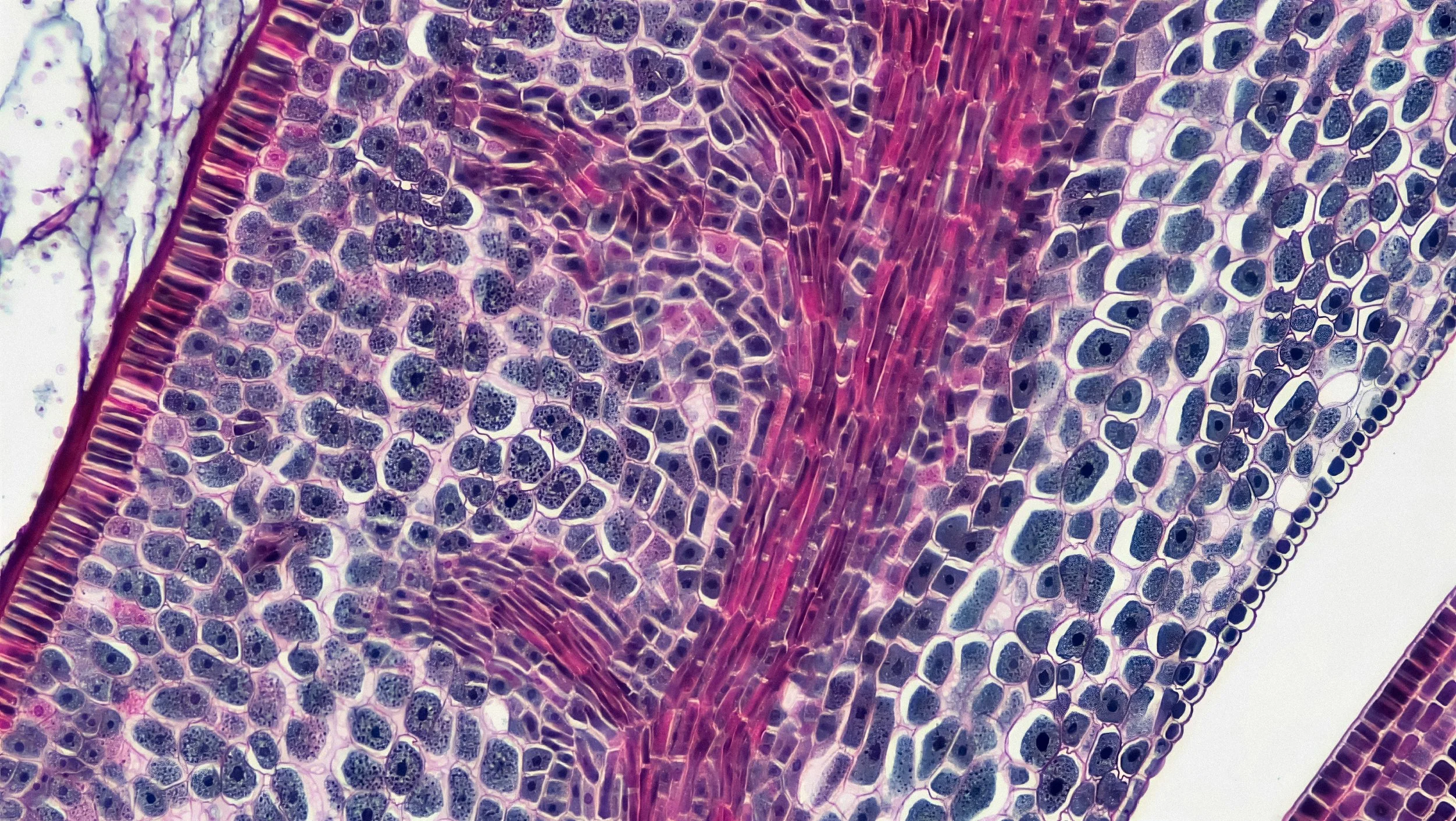 Liver Disease and End-of-Life Care: Hospice for Cirrhosis
