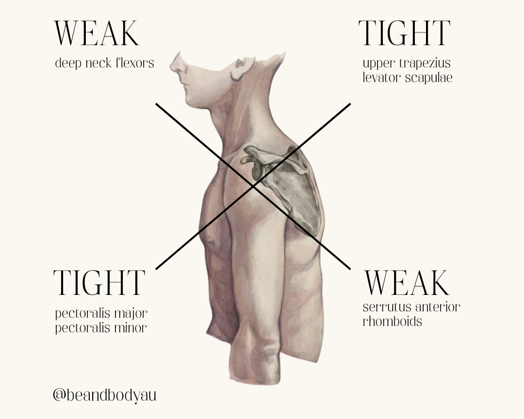 Learn About: Proximal Cross Syndrome A.K.A Upper Cross Syndrome