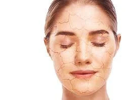 téléchargement (40).jpg