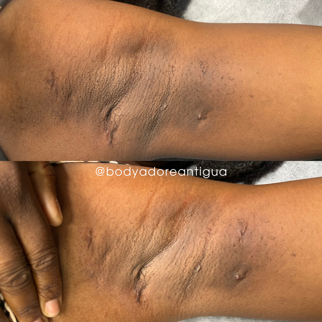 Jaye Armpit Lightening.png