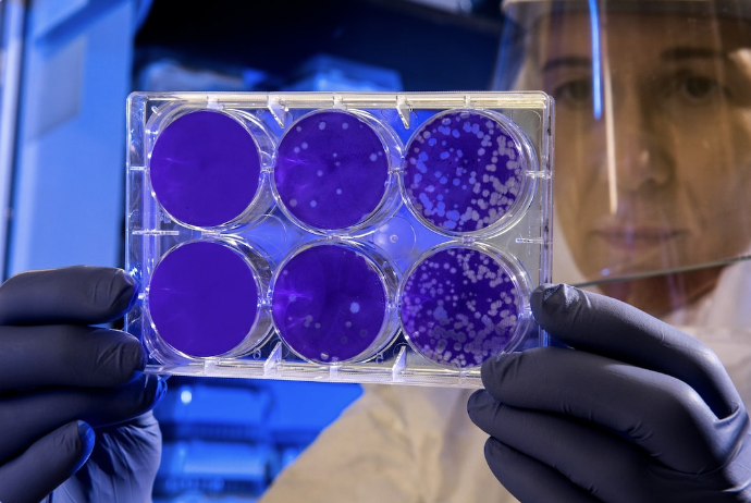 California Records "Extremely Rare" Case of Locally Acquired Dengue Virus