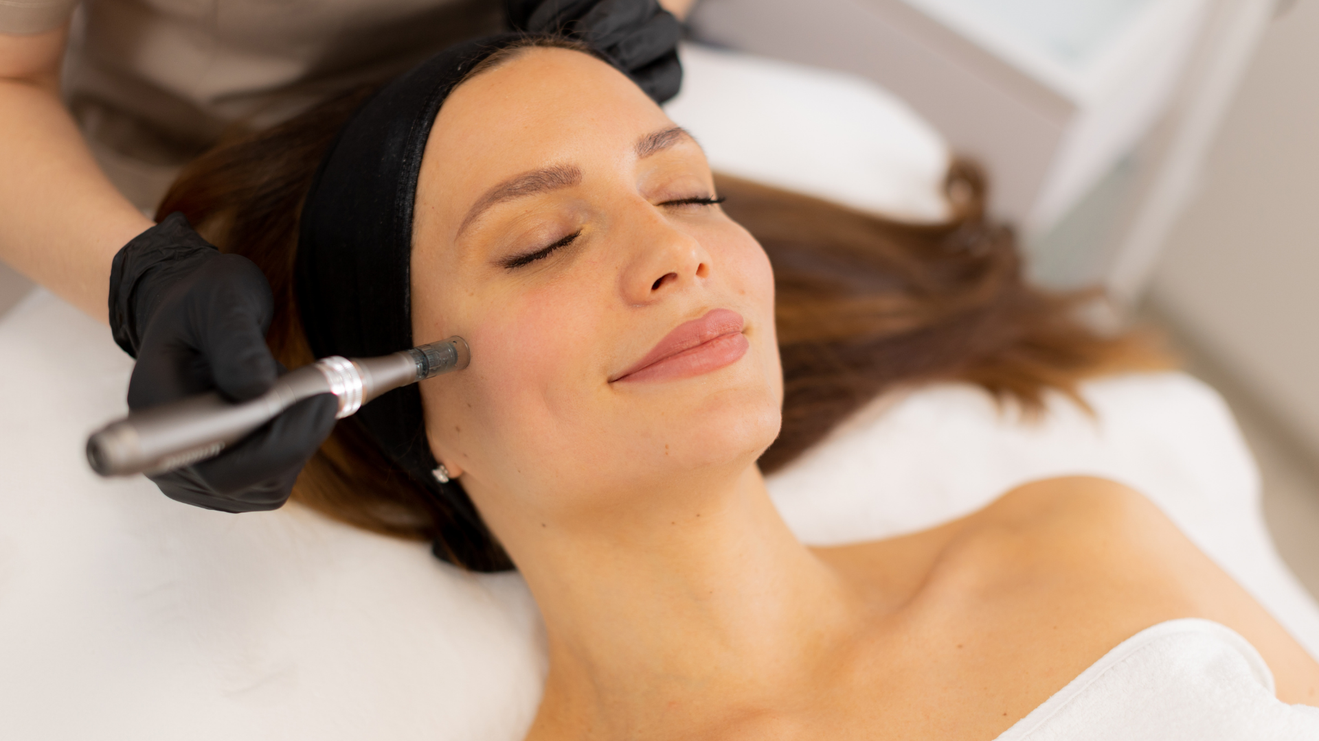 Allure Body Boutique l Microneedling Near Me
