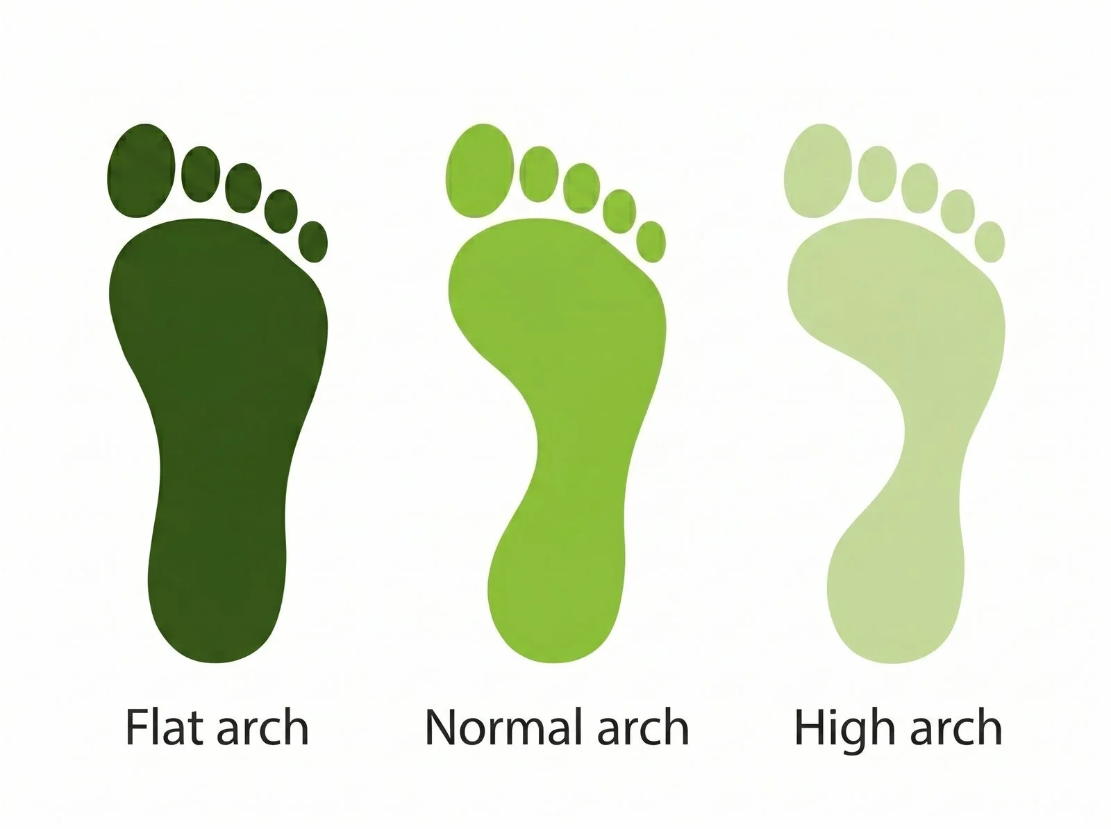 foot arch type chart showing flat, normal, and high arches