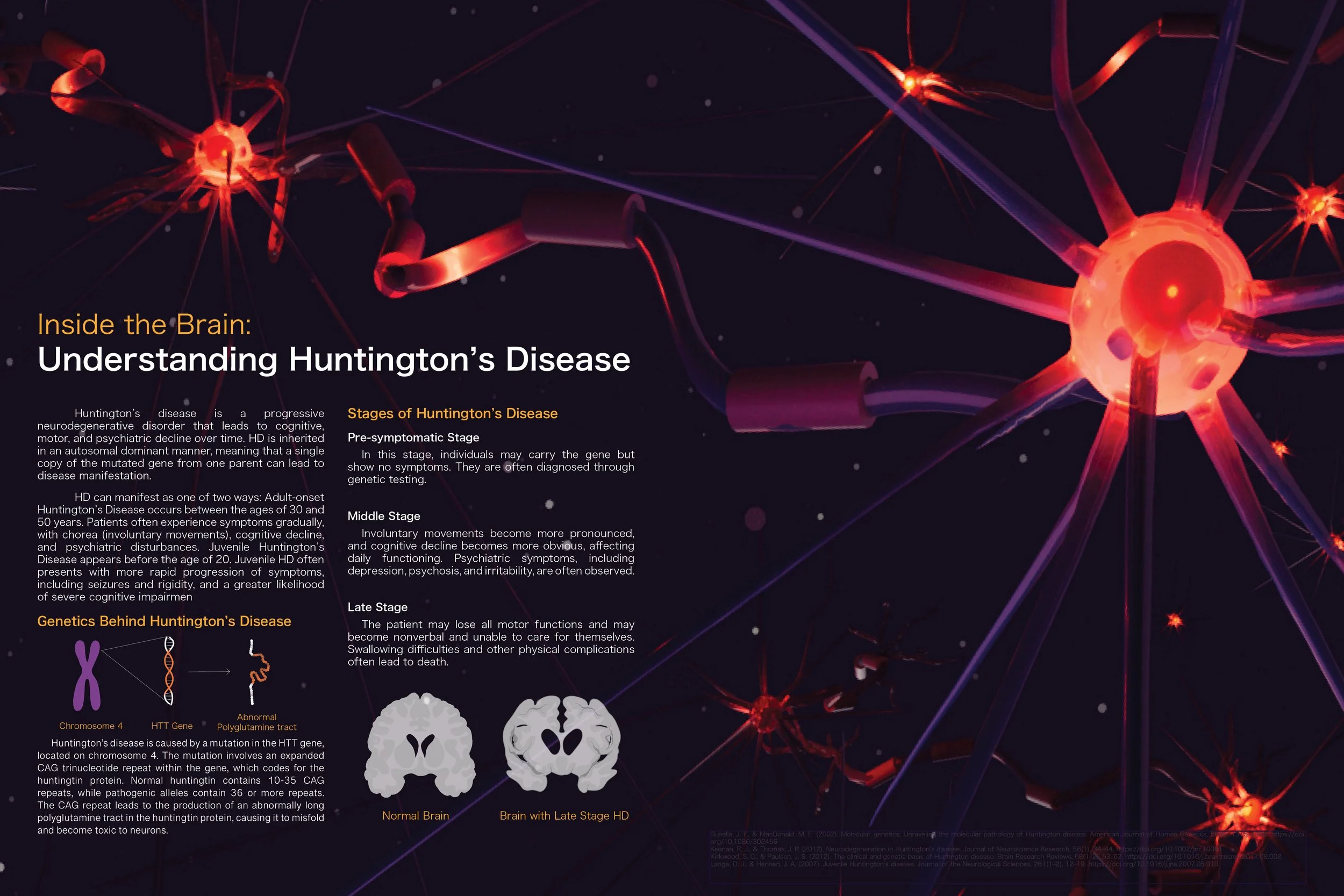 FMorell_HuntingtonsDisease_10192025.jpg
