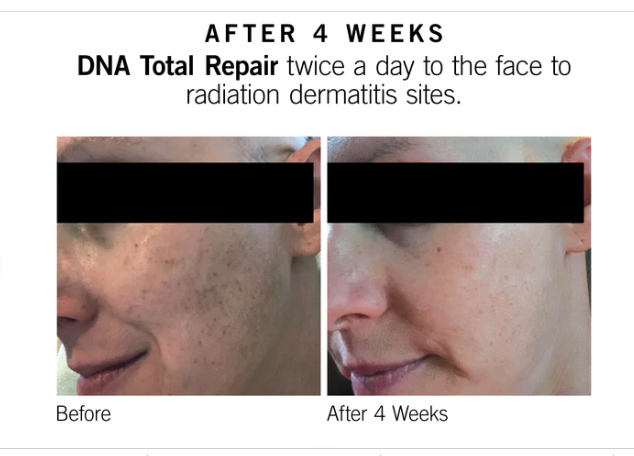 Dr. Nola Hasletine @PureDermNola.com
