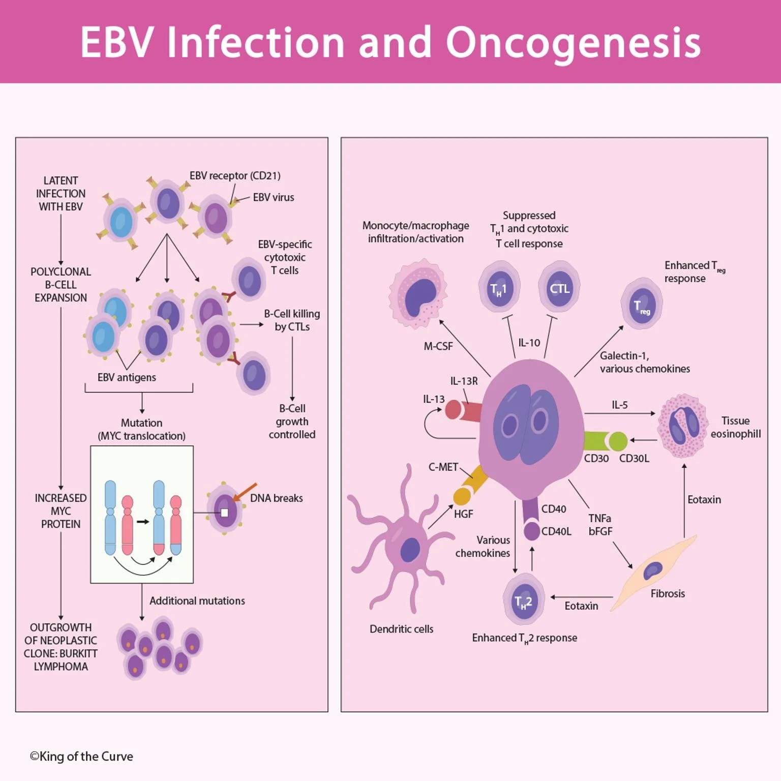 🦠 EBV Infection and Oncogenesis
