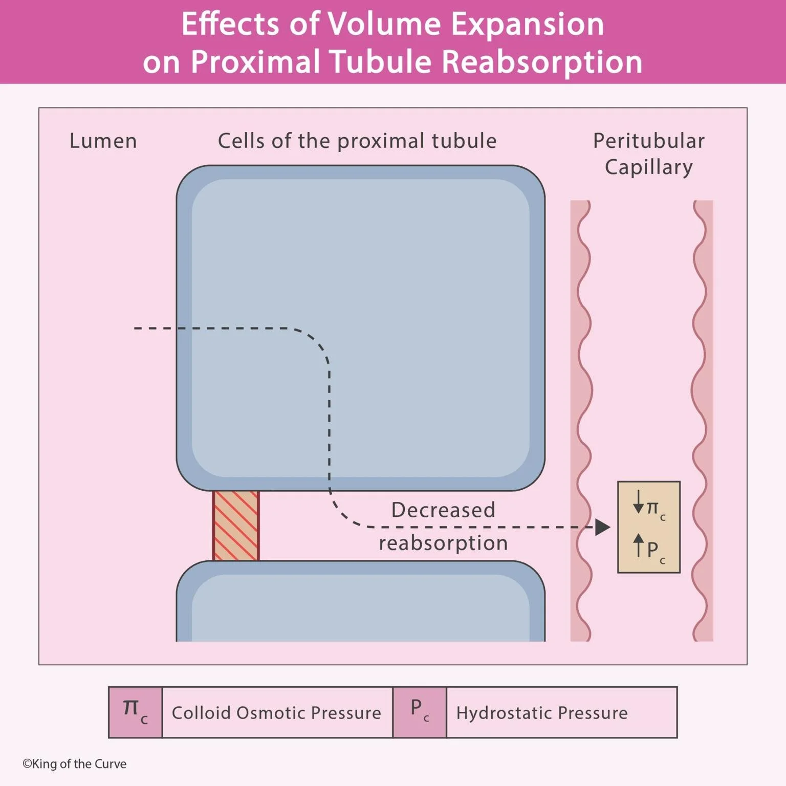 🩺 Effects of Volume Expansion on Proximal Tubule Reabsorption