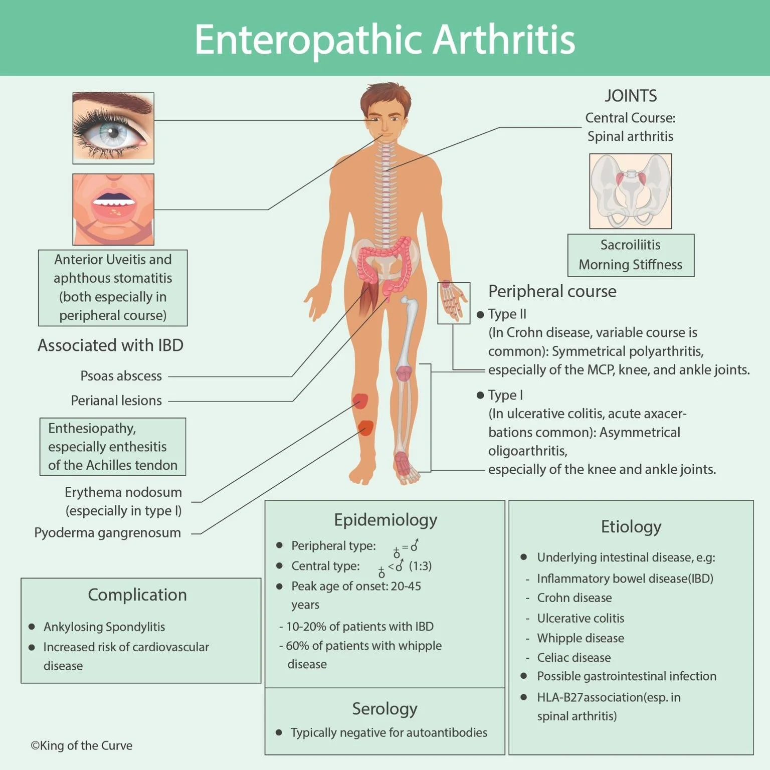 π Enteropathic Arthritis: Causes, Symptoms, and Associations