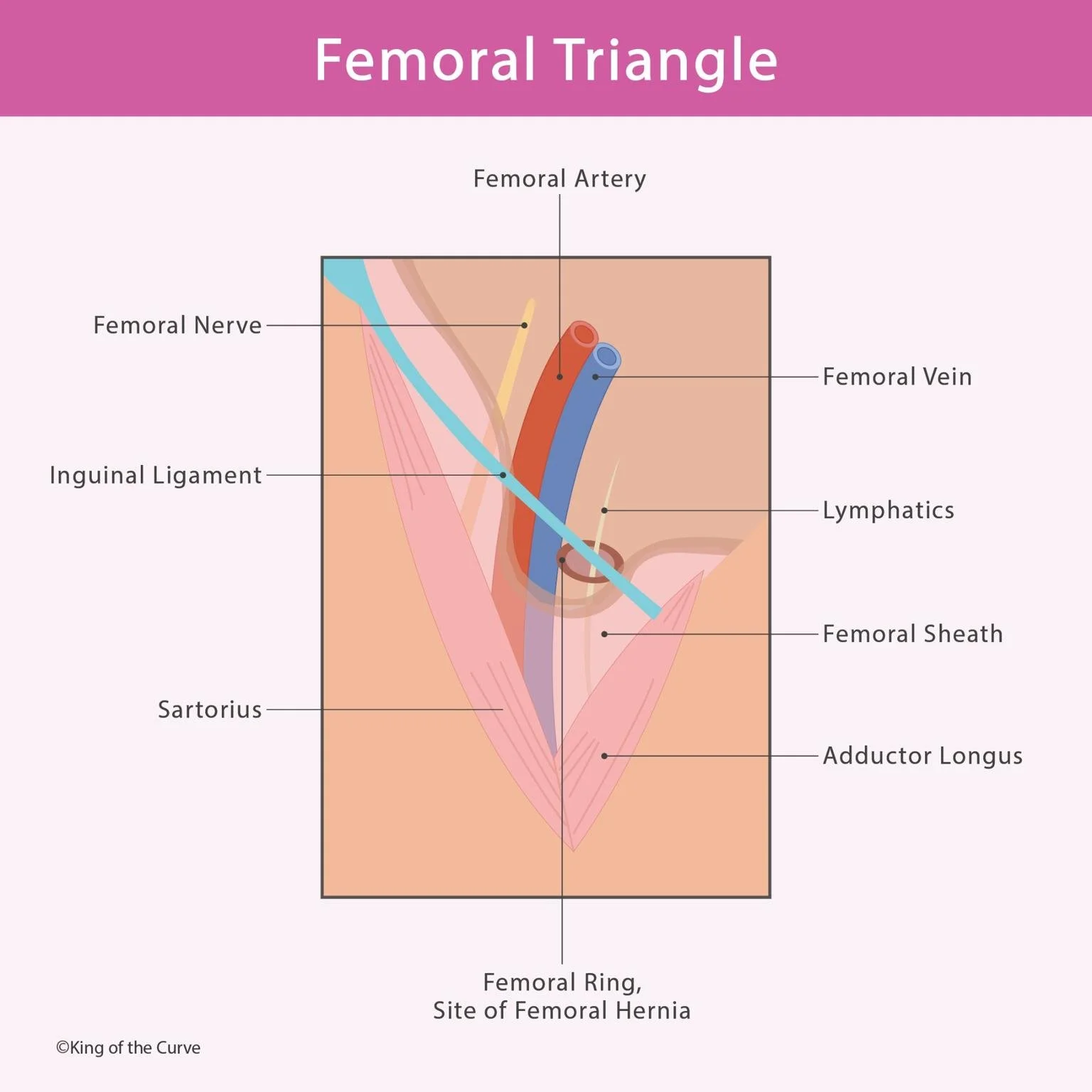 🦵 Femoral Triangle: Anatomy and Clinical Relevance