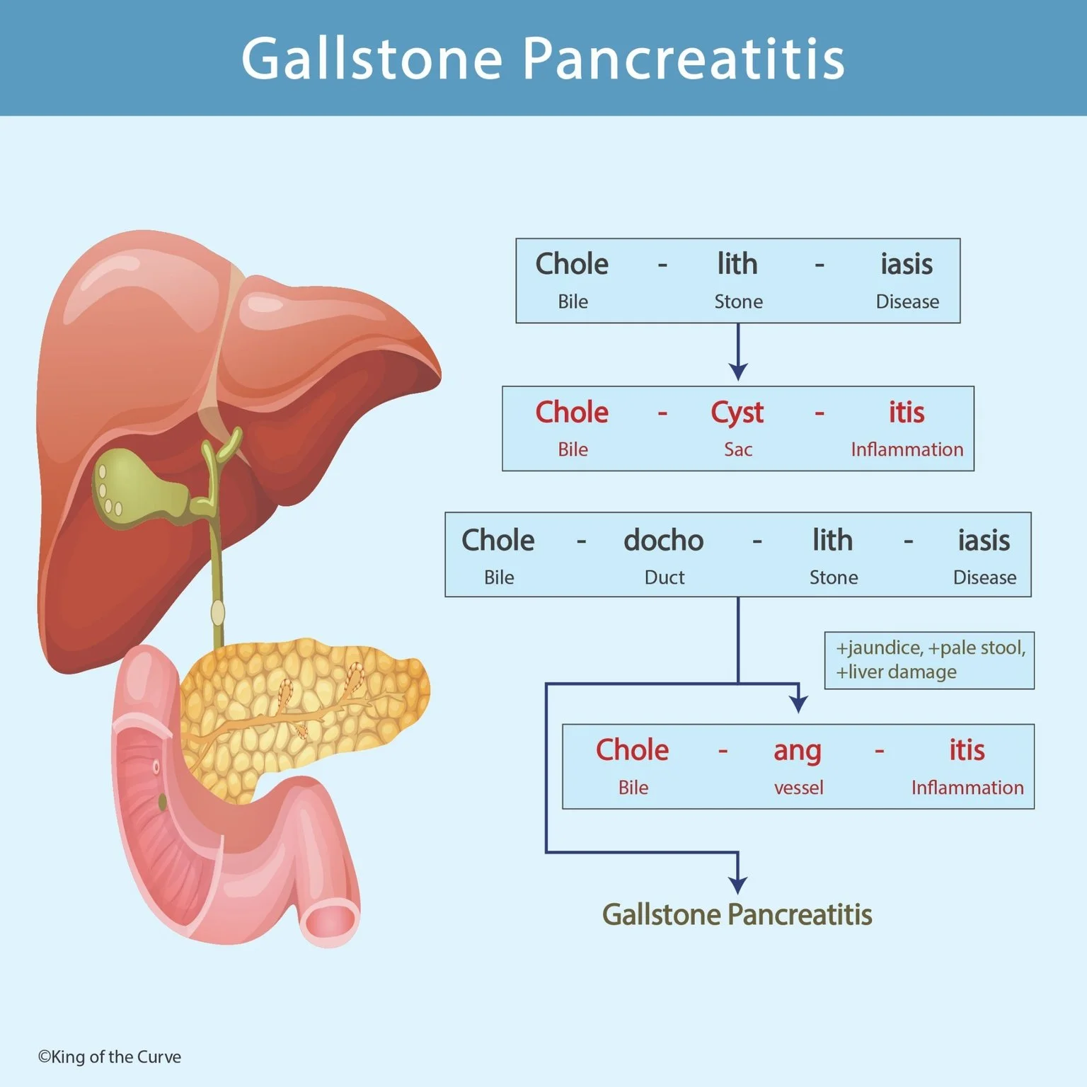 📘 Gallstone Pancreatitis: From Cholelithiasis to Cholangitis (MCAT & NCLEX Guide)
