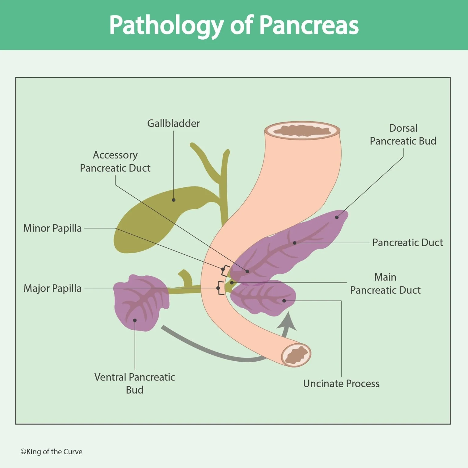🩺 Pathology of Pancreas: Anatomy, Duct System, and Clinical Significance