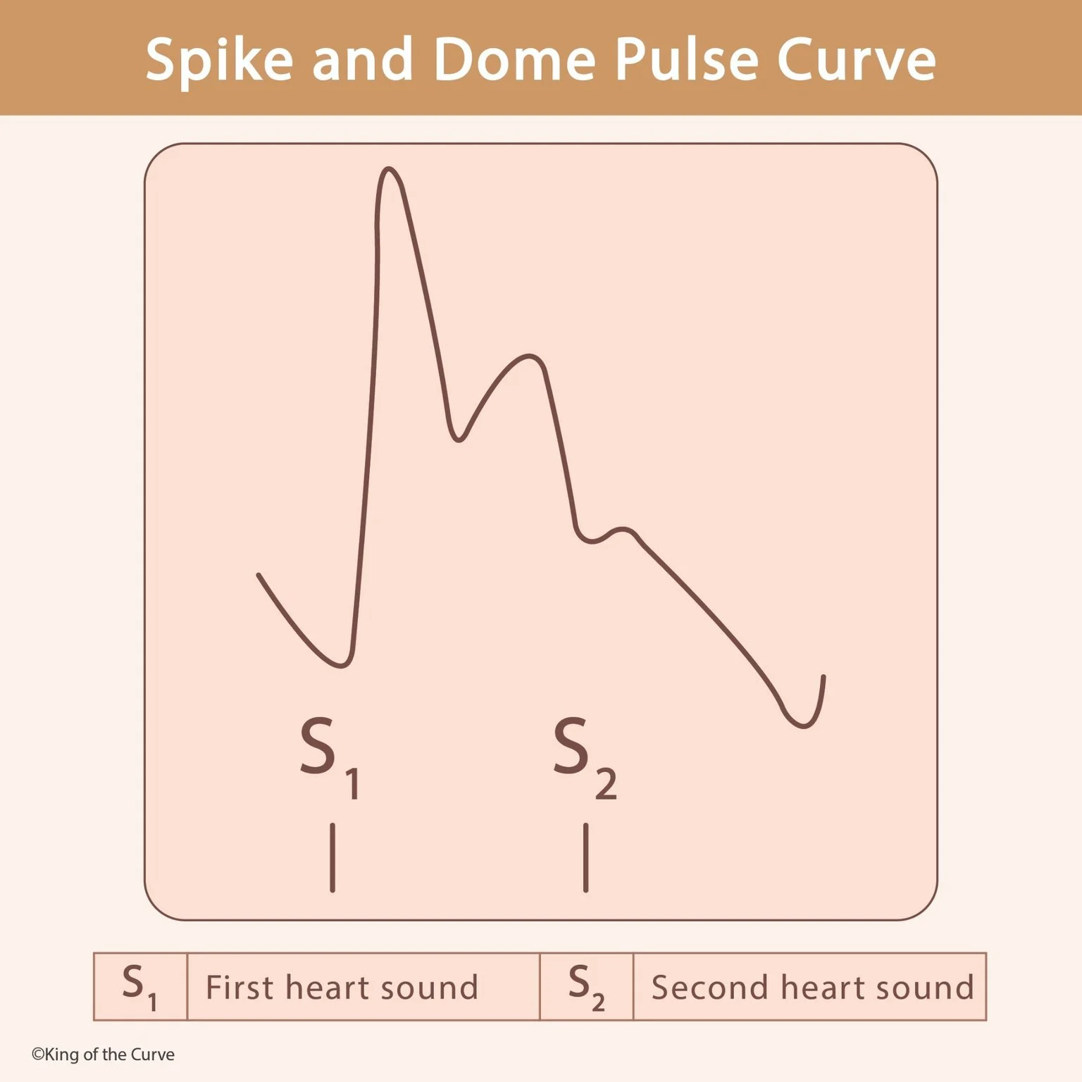 ❤️ Spike and Dome Pulse Curve: Understanding Pulsus Bisferiens