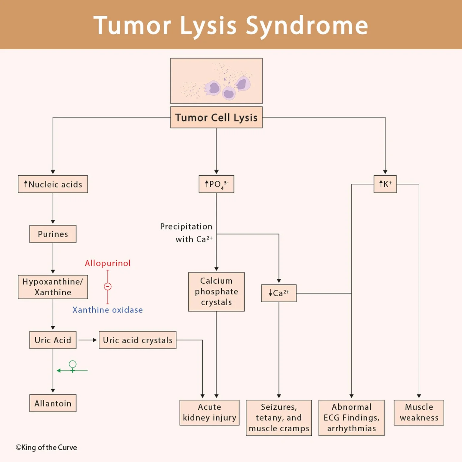 🧬 Tumor Lysis Syndrome: A High-Yield Metabolic Emergency