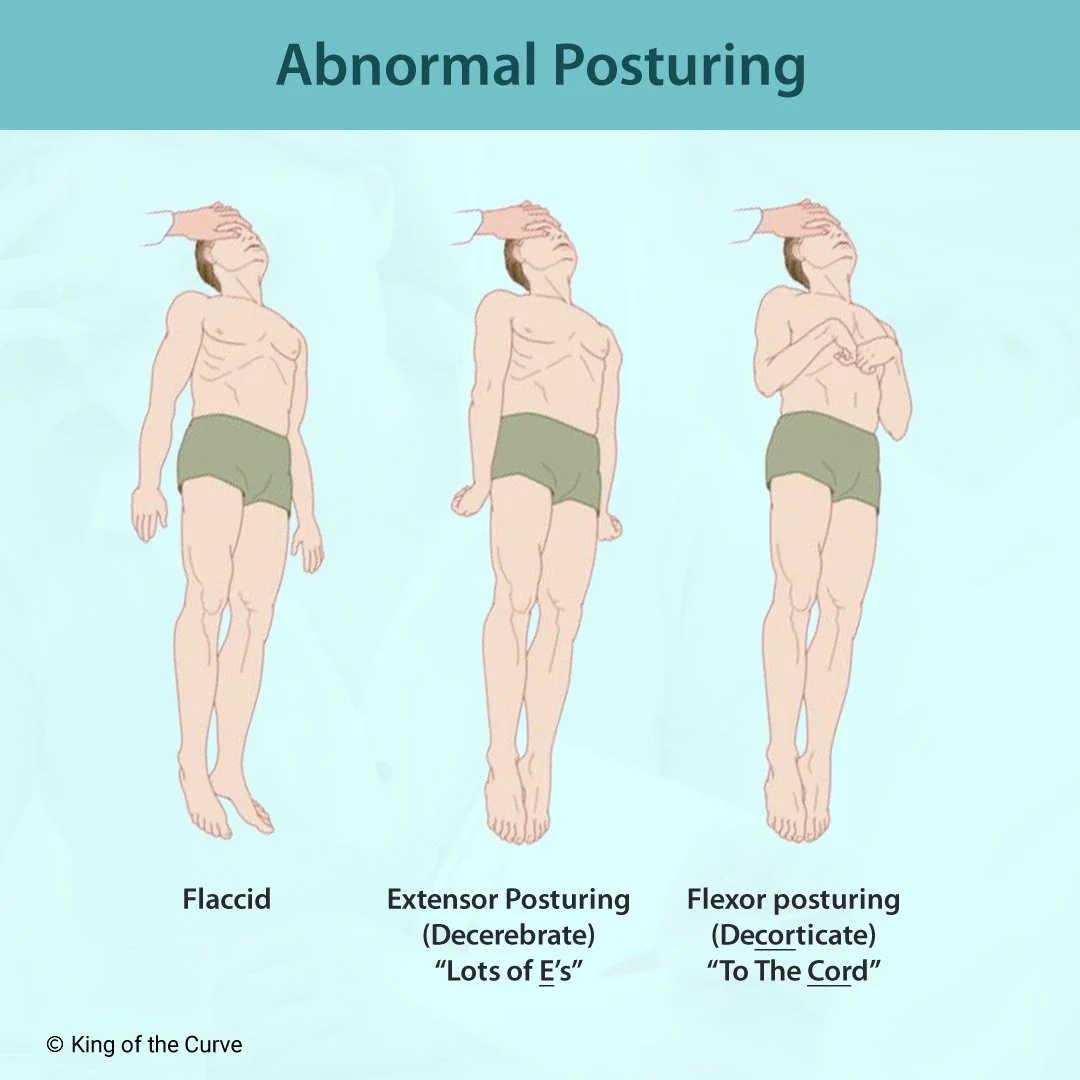 Abnormal Posturing NCLEX Guide: Decorticate vs. Decerebrate vs. Flaccid ...