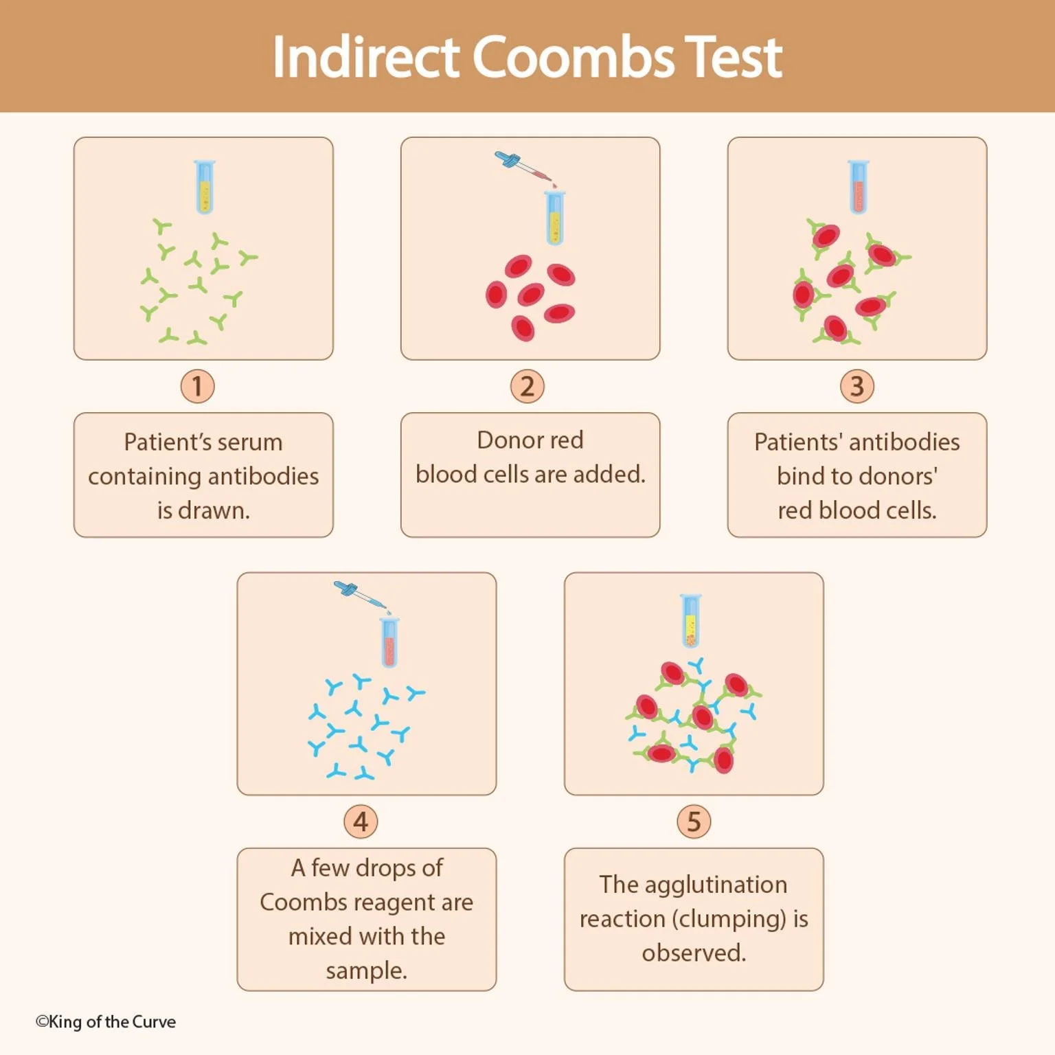 🩸 Indirect Coombs Test: Understanding the Antibody Screening Process