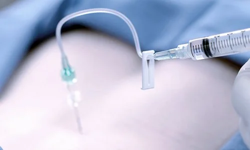 David Garas MD pain injection natick ma