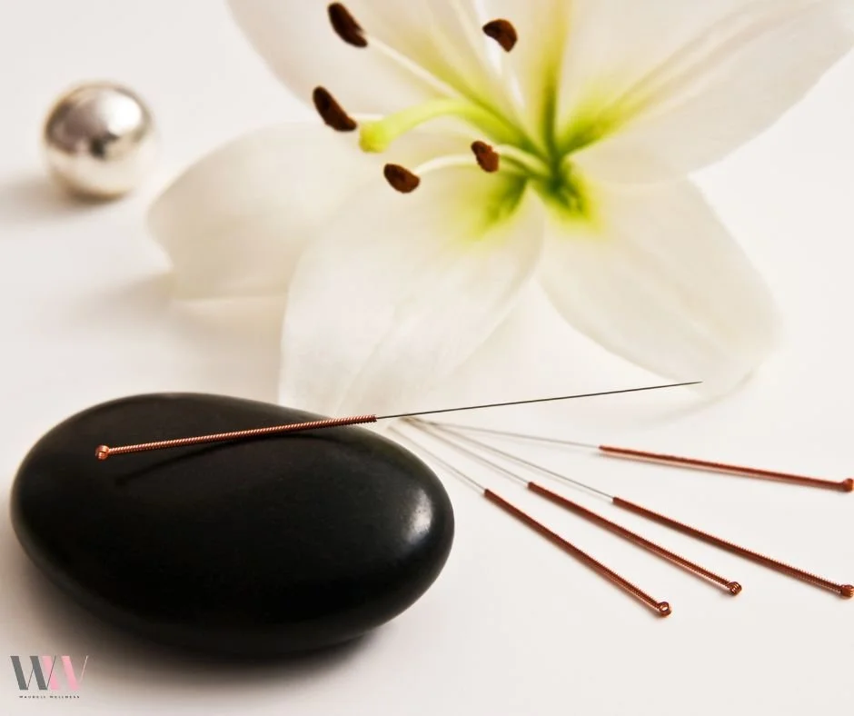 Prioritize Self-Care with 30-Minute Acupuncture Sessions