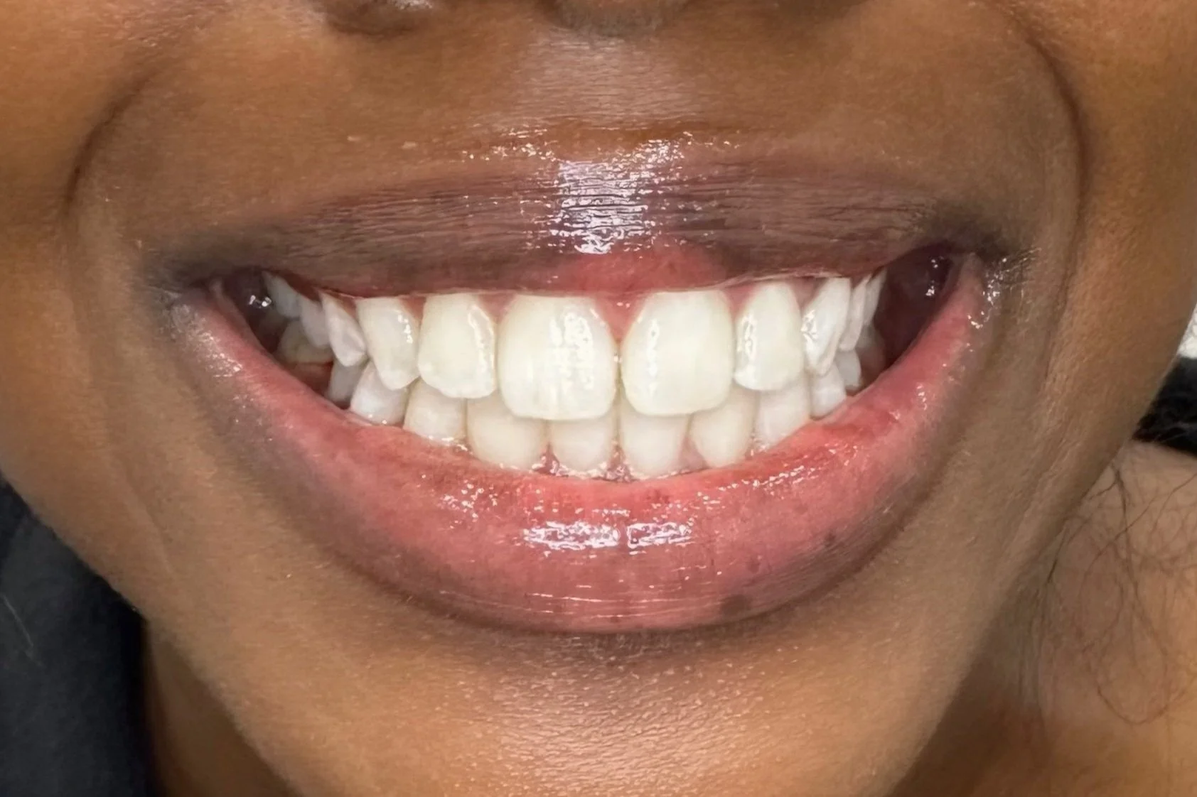 Close-up of a person's smiling face showing teeth and lips.
