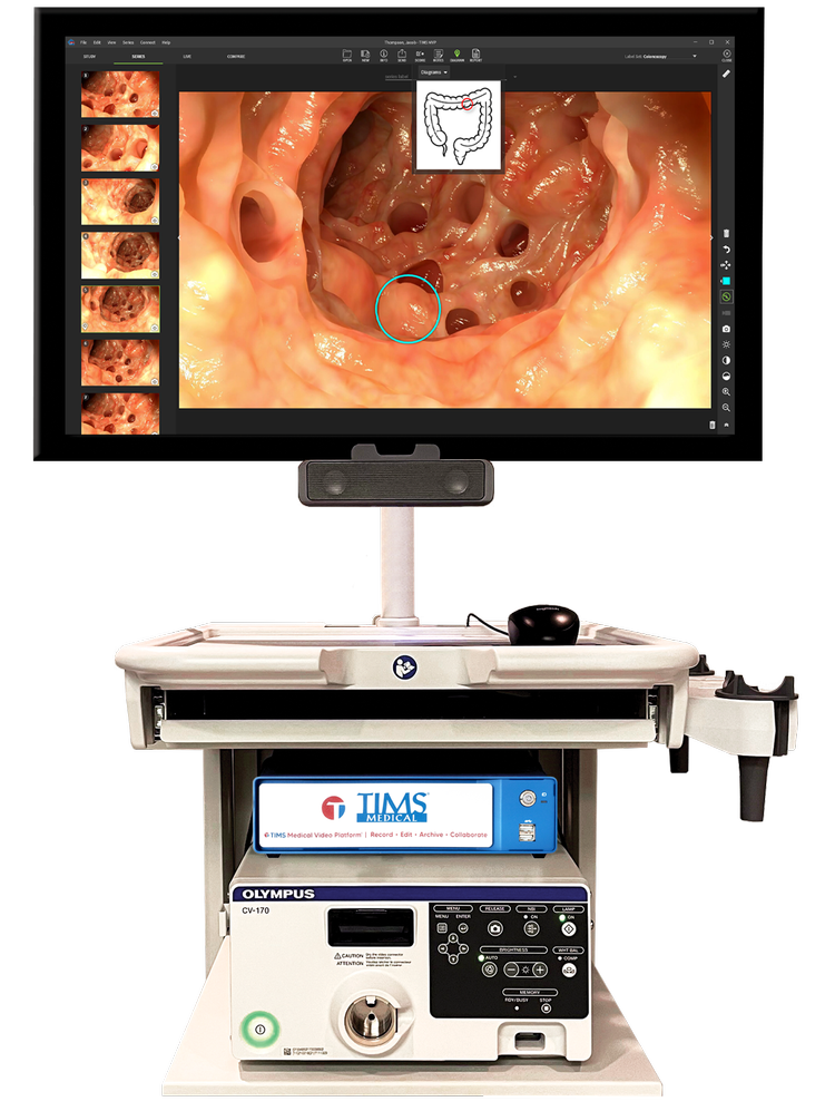 Tim's Medical Router TIMS MVP for Epic Lumens | TIMS Medical