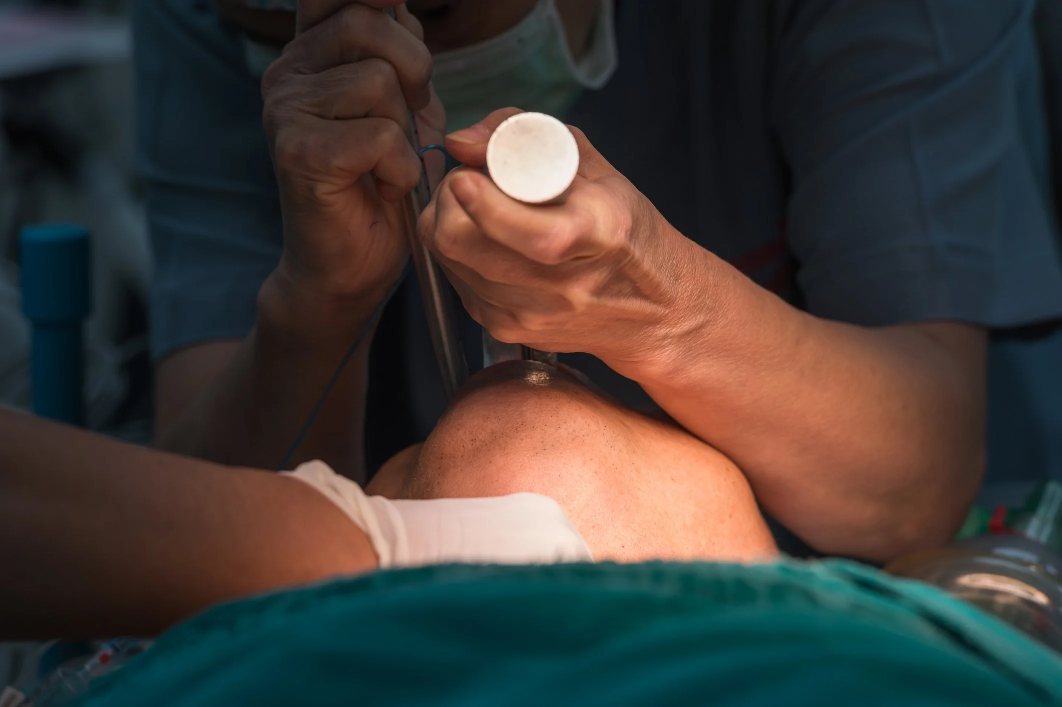 Acute Laryngeal Injury: Risks, Outcomes, and Clinical Considerations