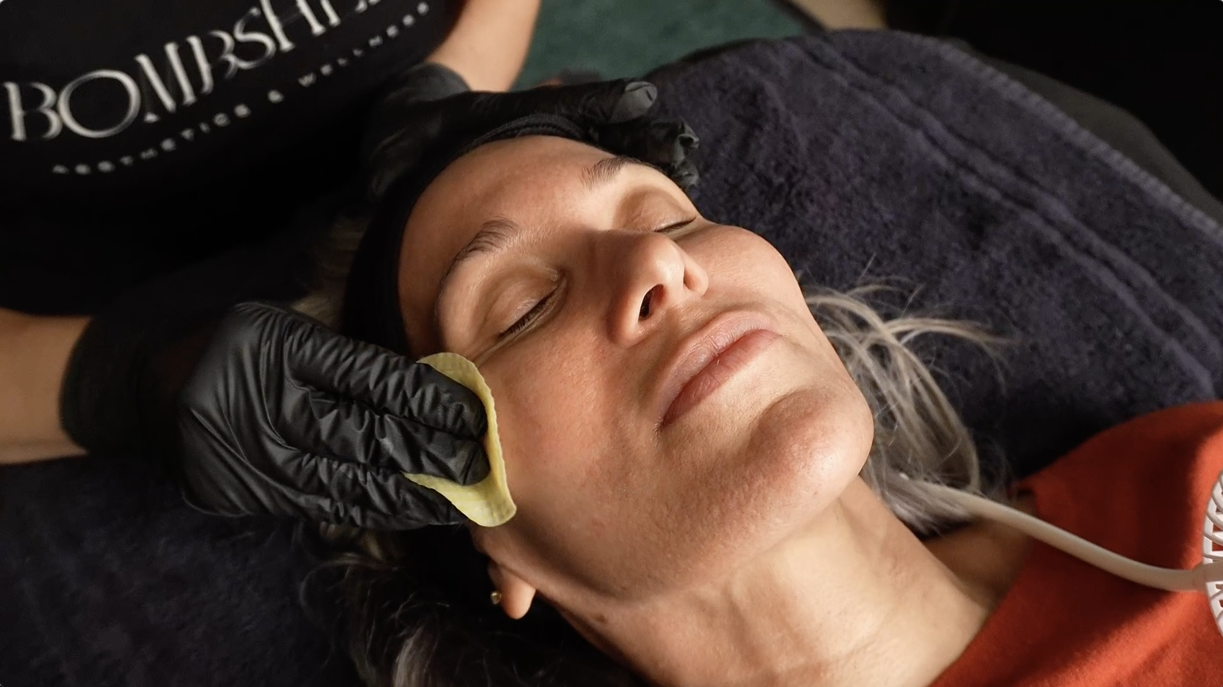 client receiving a chemical peel at Bombshell Aesthetics in Bedford NH