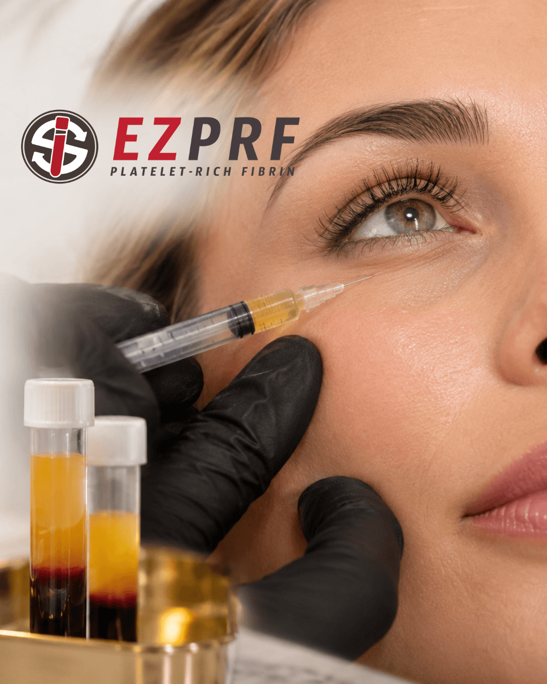 EZ gel PRF at Bombshell Aesthetics in Bedford, NH 