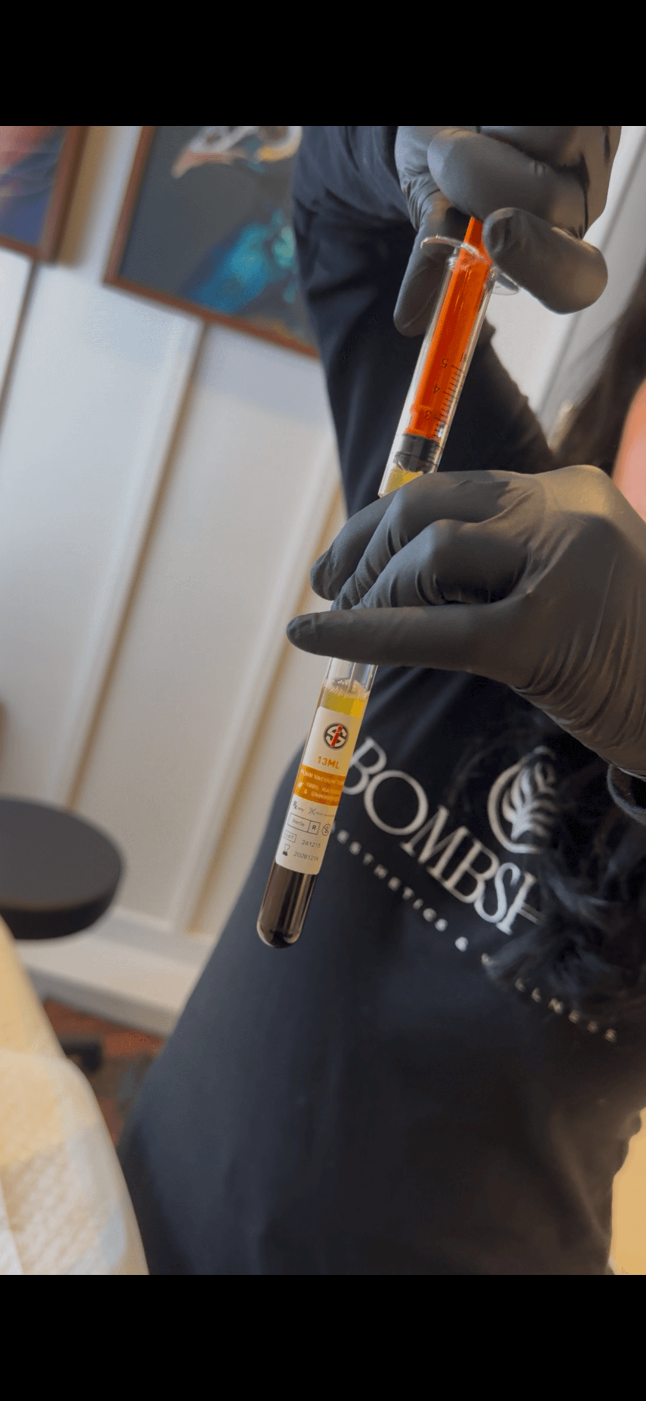 provider at bombshell aesthetics in bedford nh providing a treatment for EZ Gel PRF