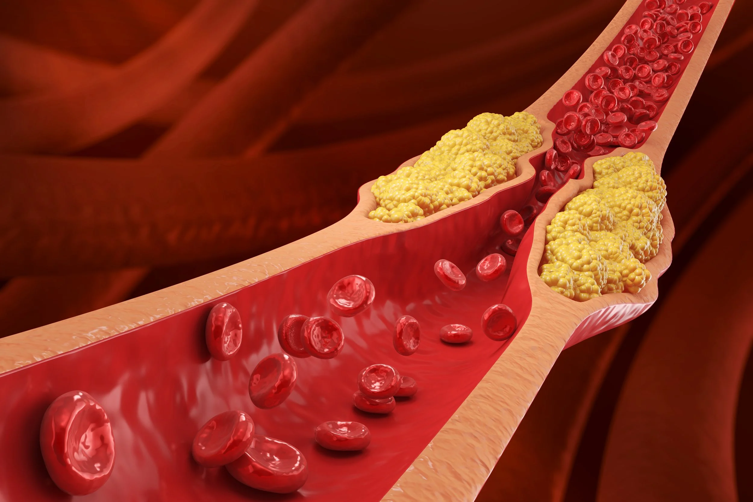 A New Oral Cholesterol-Lowering Pill: What Enlicitide (LIPFENDRA) Means for Heart Disease Prevention