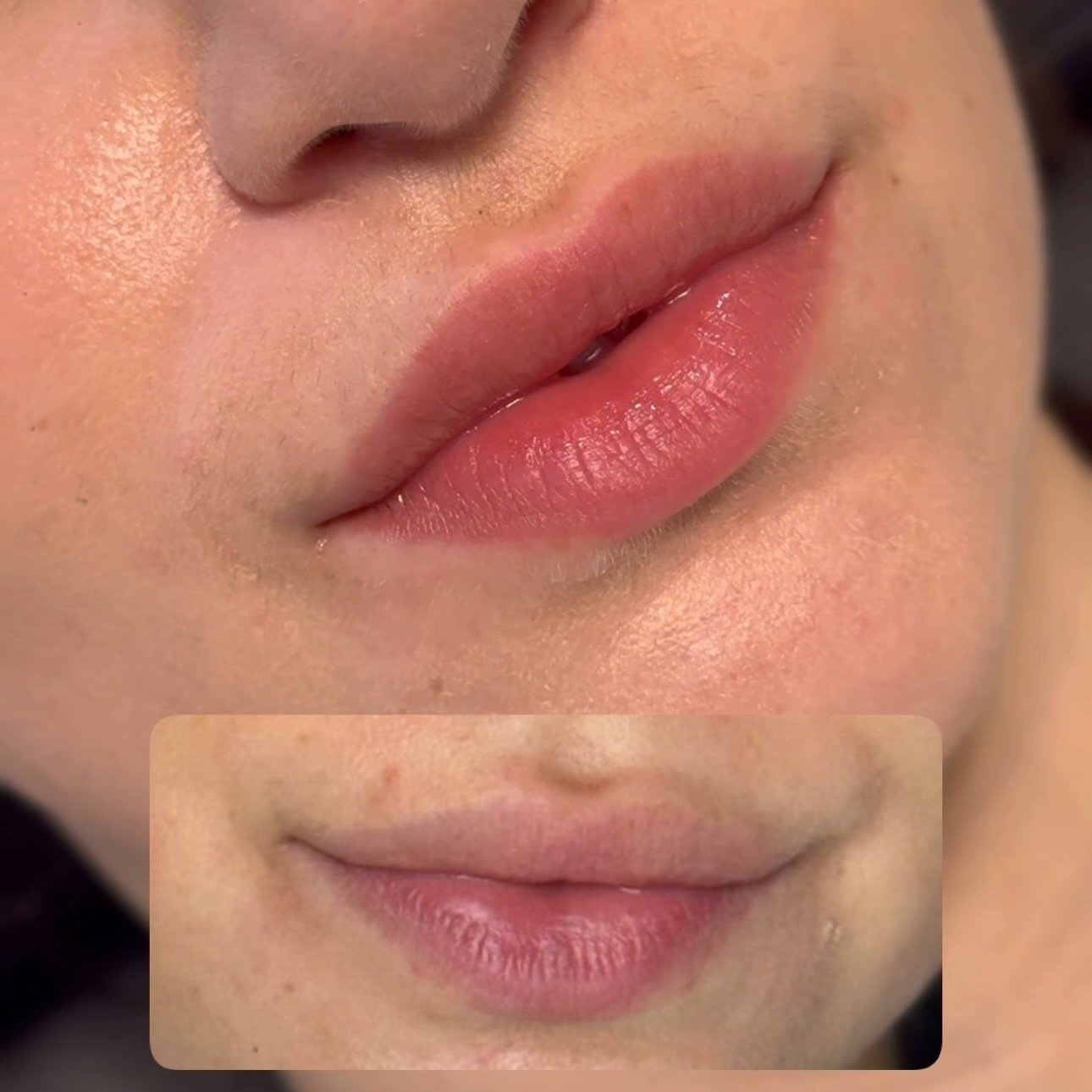 My focus with lip blush is not to replace your lipstick but to restore your lip colour and shape. Wear your fav clear gloss in the day and your fav lipstick at night 🫦 #healedlipblush 

Click my link in bio to book your Toronto appointment. Email to