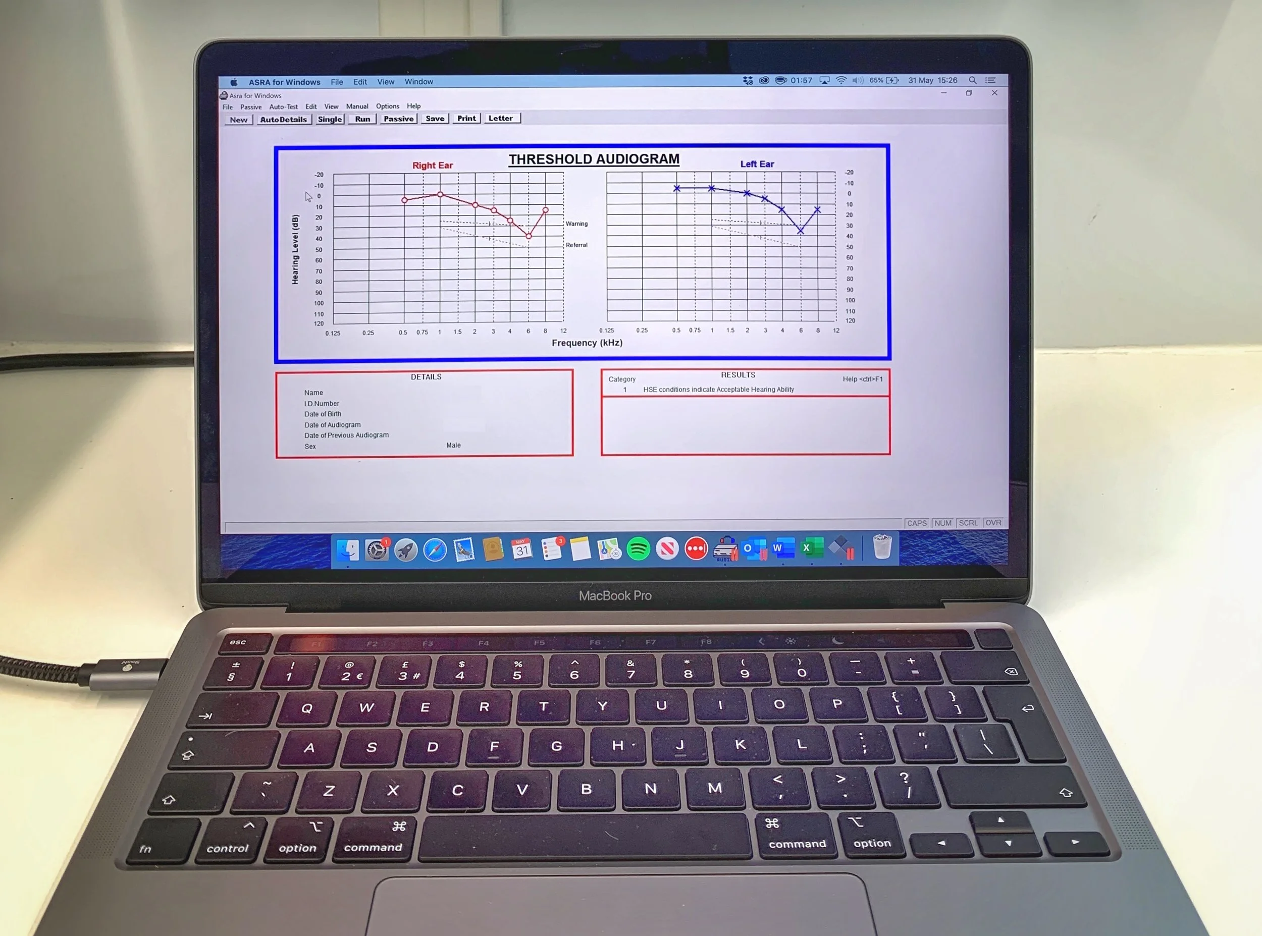 Who to include in health surveillance for noise exposures (hearing testing)