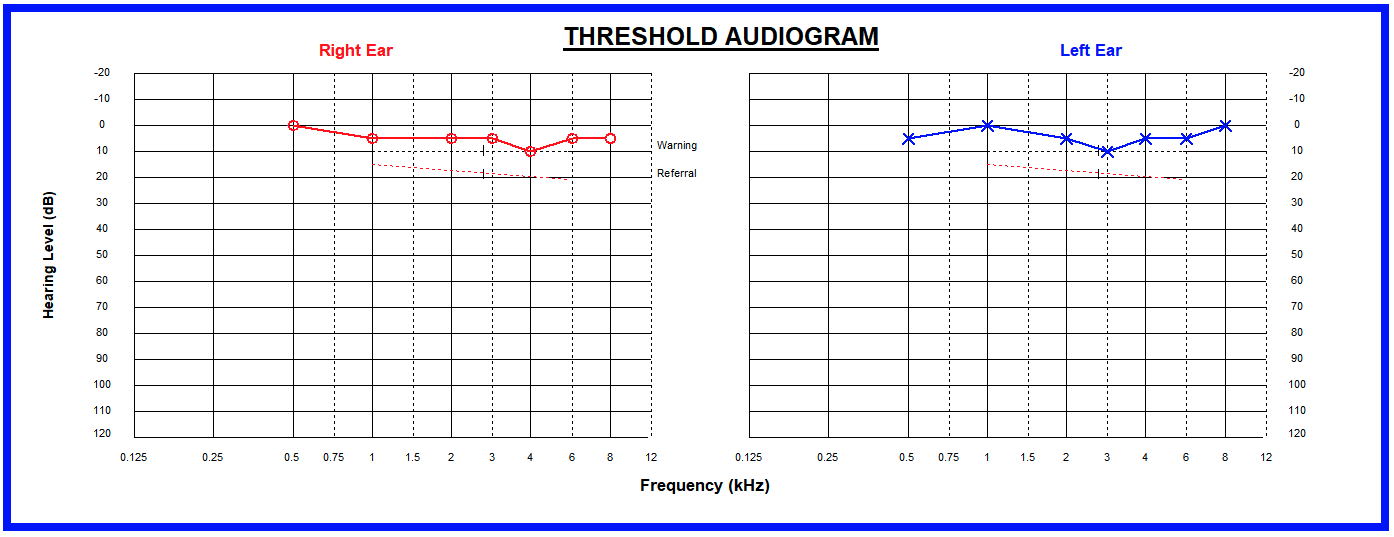 A hearing test result chart showing perfect hearing - flat lines for both ears
