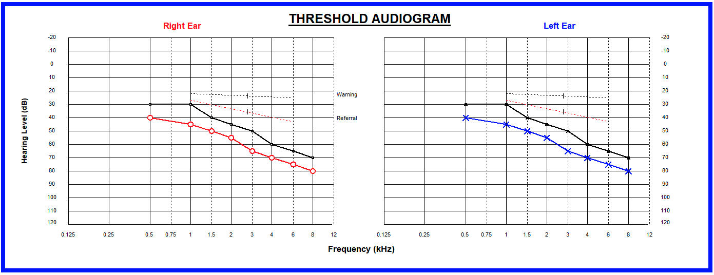 Audiogram showing the lowest limits of normal hearing for both male and females at the age of 65.