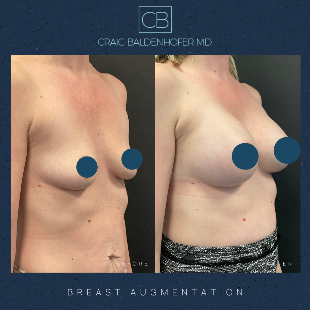 Copy of Neutral Rustic Before After Photos Instagram Post - 25.PNG