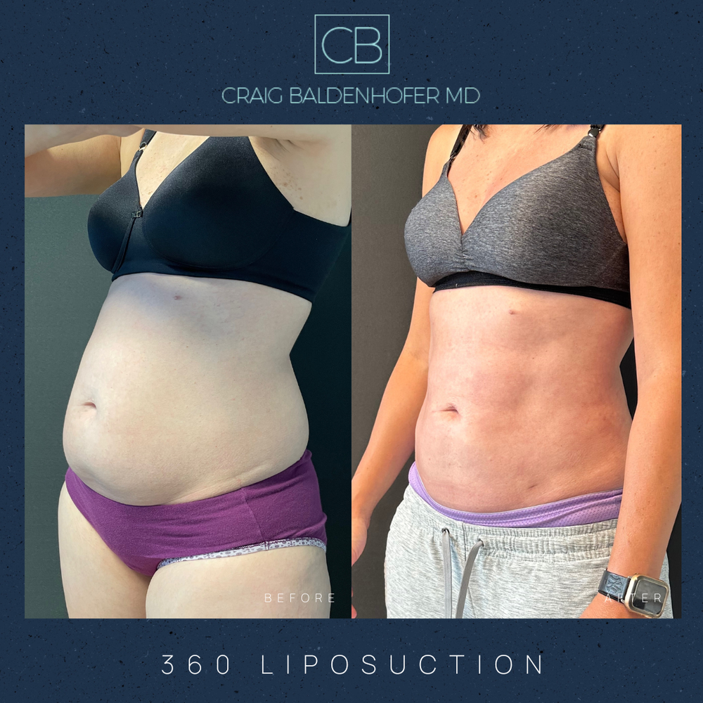 Copy of Neutral Rustic Before After Photos Instagram Post - 27.PNG