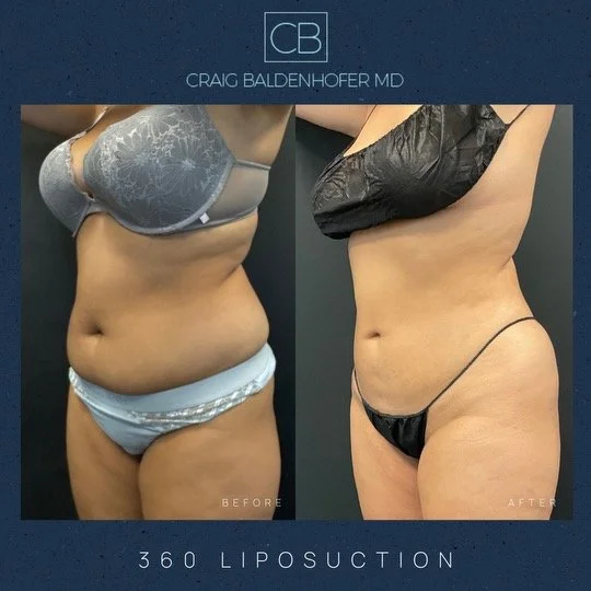 Copy of Neutral Rustic Before After Photos Instagram Post.zip - 22.JPEG