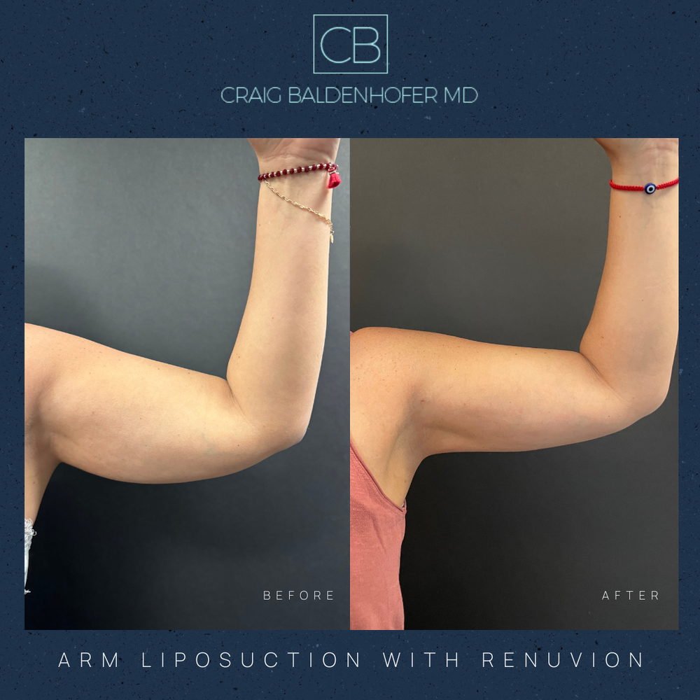 Copy of Neutral Rustic Before After Photos Instagram Post.zip - 69.PNG