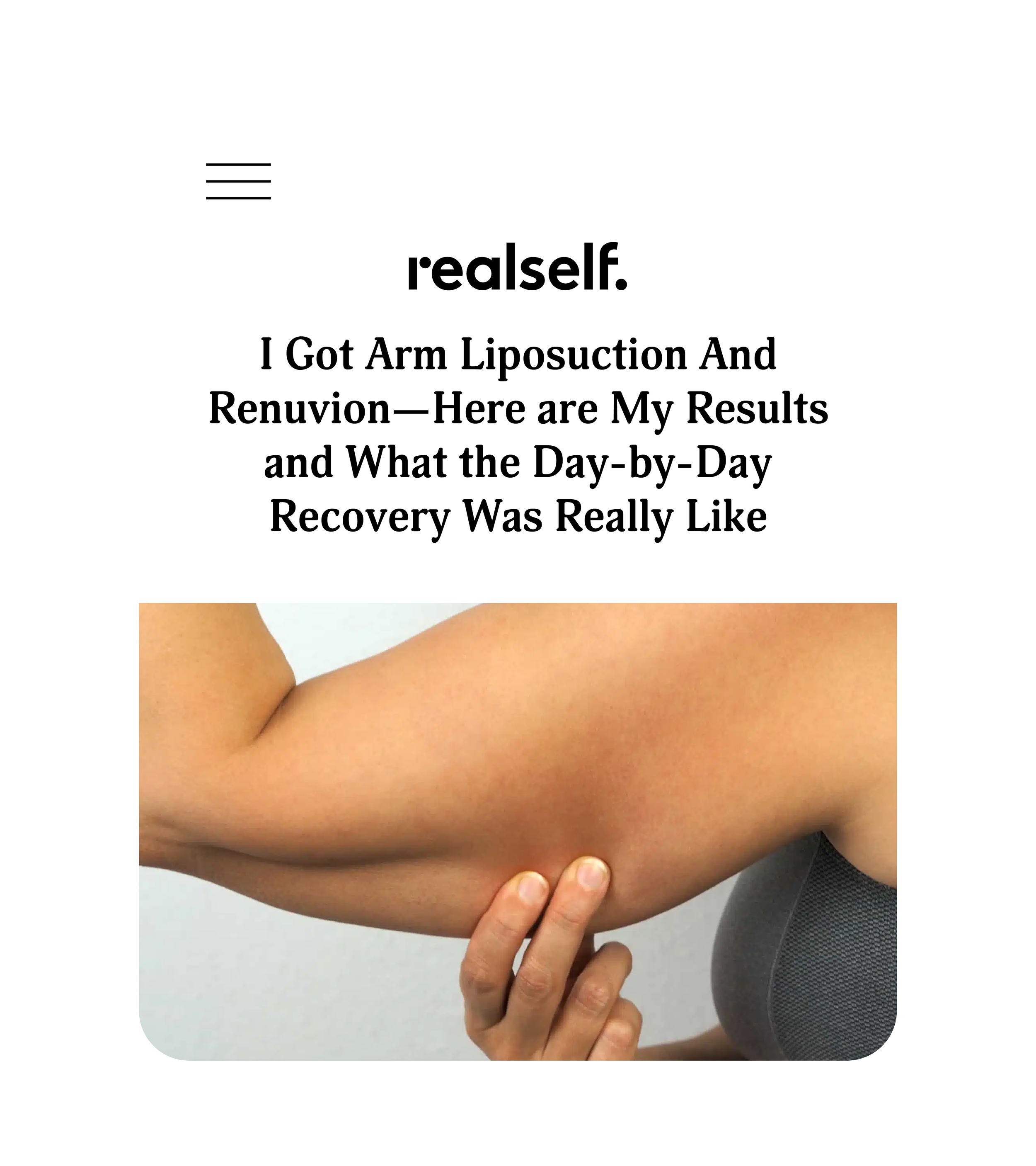 Kaplow Health Client Renuvion realself