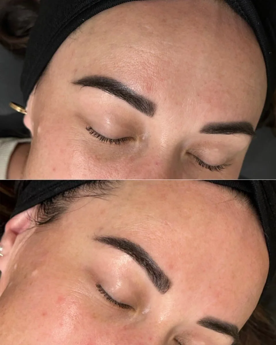 Finally it&rsquo;s here! 🤩 

Introducing our newest treatment.. Hydrodermabrasion 💁&zwj;♀️ After months of hard work to get this ready, we are so excited to introduce this service to BodySculpt Aesthetics! 

This treatment will: 
&bull;	Instantly r
